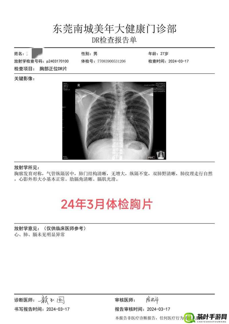 100%胸片曝光率与曝光率 2024 之关键探索